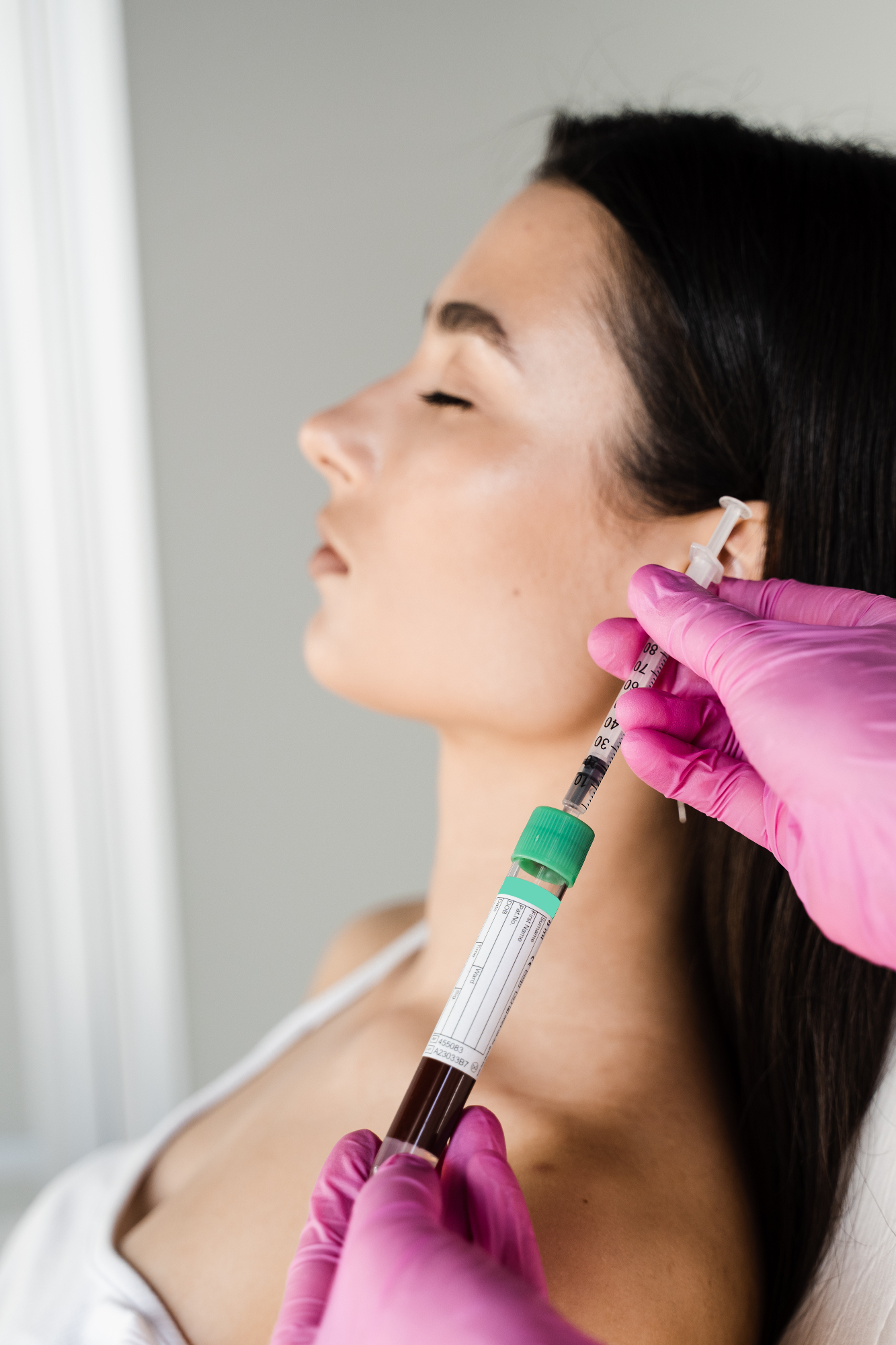 Kako se je sestrična odločila za botox in kako ji je spremenil samopodobo